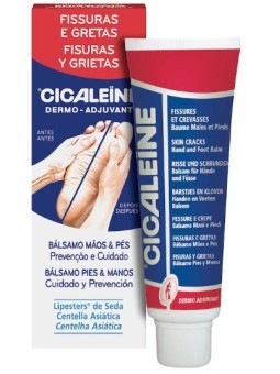 Akileine Cicaleine Fisuras...